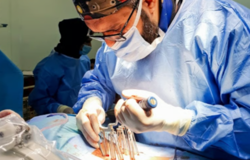 Minimal Invasive Spinal Fixation